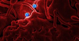 explore meniere's disease, a chronic inner ear condition that affects balance and hearing. learn about its symptoms, causes, diagnosis, and effective management strategies to improve quality of life.