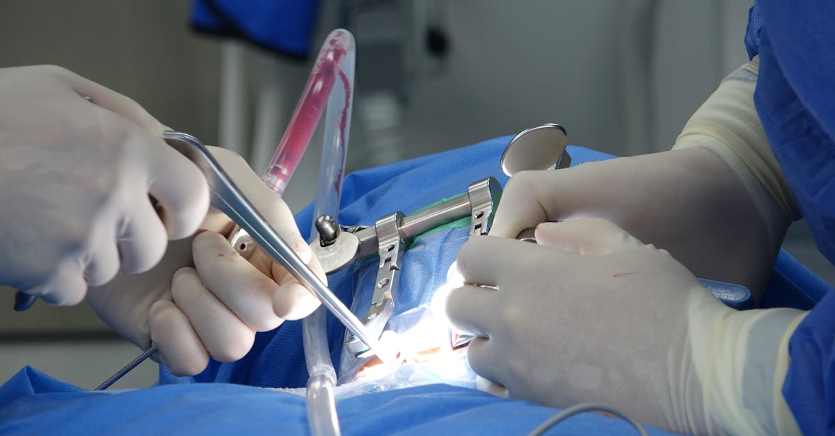 learn about spinal stenosis, its causes, symptoms, and effective treatment options. discover how this condition can affect mobility and overall quality of life, and explore strategies for managing pain and improving function.