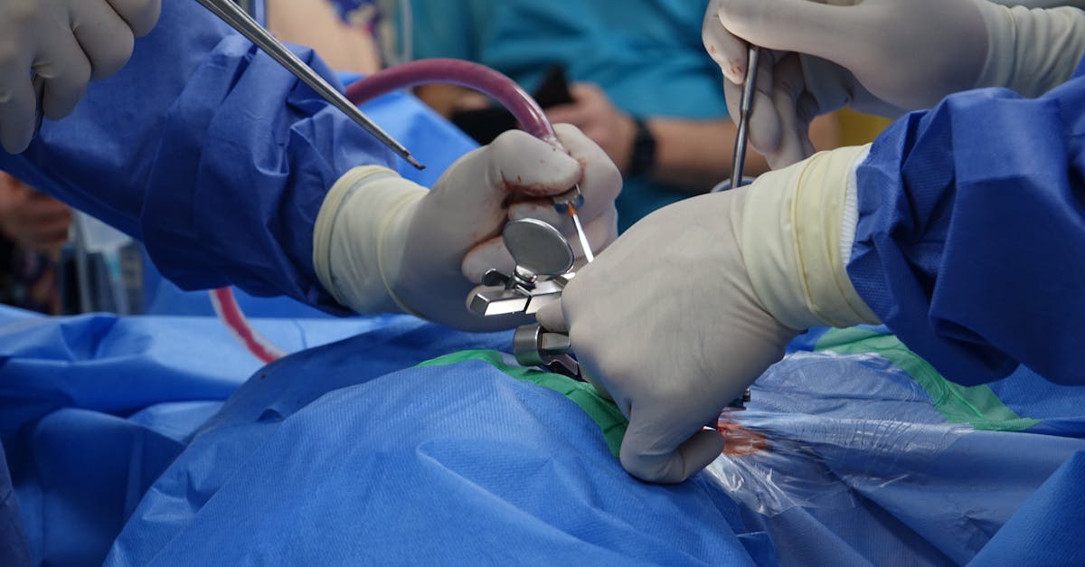 discover the causes, symptoms, and treatment options for spinal stenosis, a condition that narrows the spaces within your spine. learn how to manage pain and enhance mobility with expert insights and effective therapies.