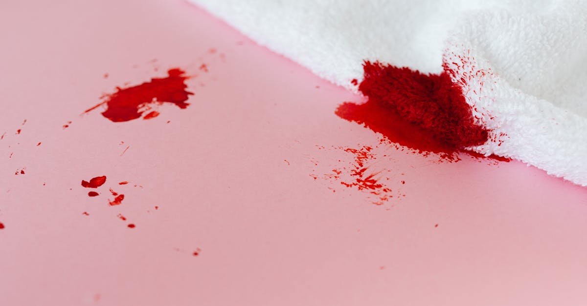 discover effective strategies to manage menstrual migraines, a common yet debilitating condition affecting many women. learn about their triggers, symptoms, and treatment options to improve your quality of life during your menstrual cycle.