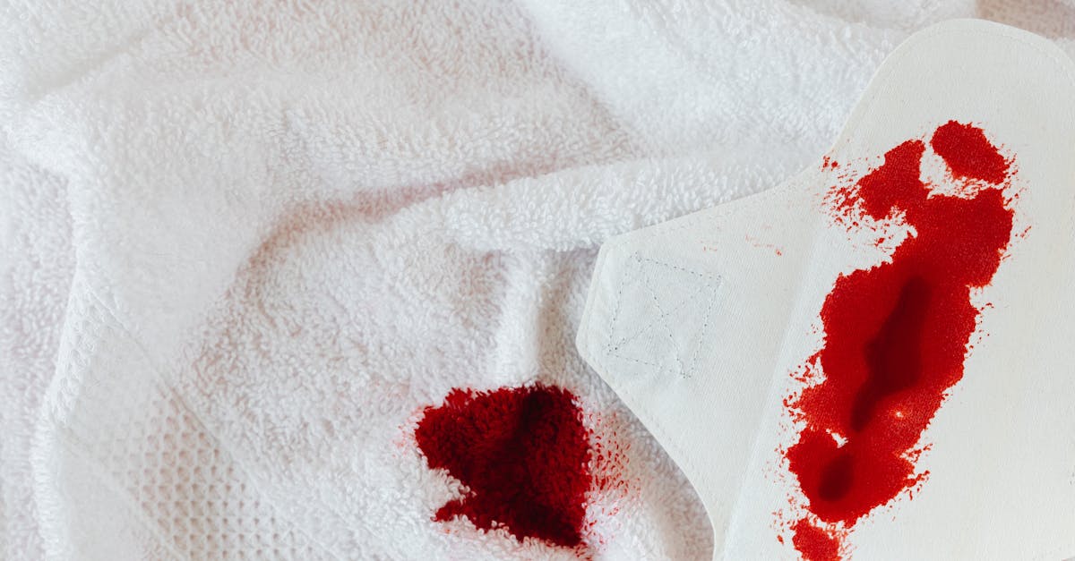 discover effective strategies to manage menstrual migraines, their causes, and treatments. learn how to alleviate pain and improve your quality of life during your menstrual cycle.
