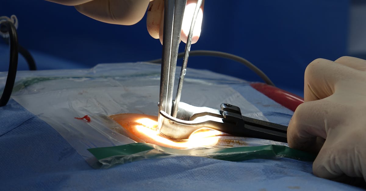 discover expert insights into spinal stenosis, a condition characterized by the narrowing of the spinal canal that can cause pain, numbness, and mobility issues. learn about causes, symptoms, and the latest treatment options to manage this condition effectively.