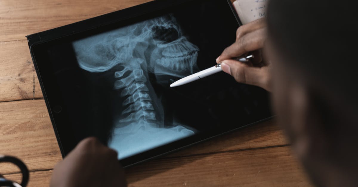 discover essential tips and expert advice on maintaining optimal spinal health. learn about common spine conditions, preventive care, and exercises to support a healthy back.