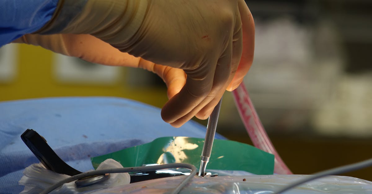 discover essential information about herniated discs, including symptoms, causes, treatment options, and prevention tips for better spine health.
